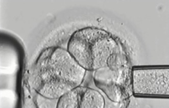 access australia preimplantation genetic diagnosis testing fact sheet 2015 dragged