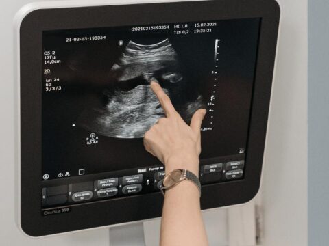 ultrasound ajfnfertilityzone